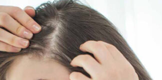 Hair Care Serum: ज्यादातर लोग अपने झड़ते बालों से रहते हैं परेशान how-to-prevent-hair-fall-for-female-naturally