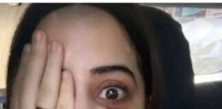 उर्फी जावेद के चेहरे को क्या हो गया! शेयर की तस्वीर Screenshot 2023-07-17 201500