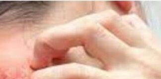 फंगल इंफेक्शन से बचाएंगे ये तरीके, जरूर अपनाएं Screenshot 2023-07-22 184849